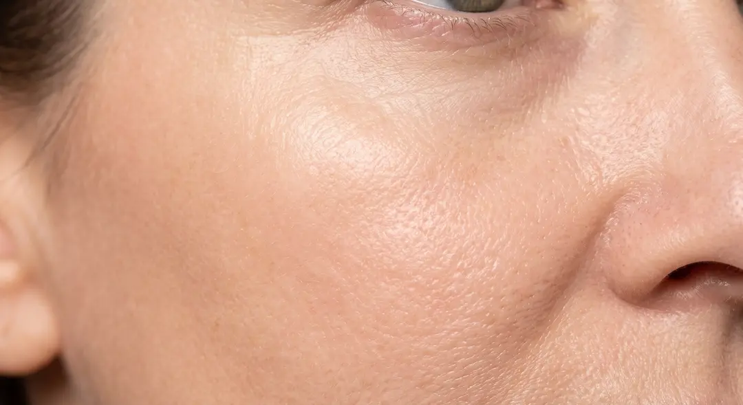 Descubre la Radiofrecuencia Facial: Tu Secreto para un Rostro Firme y Radiante sin Cirugía